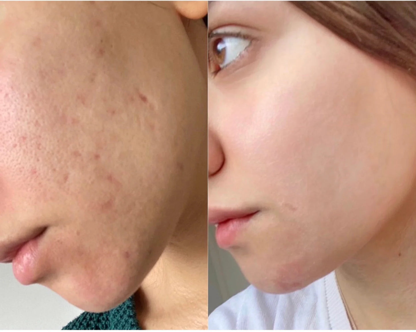 Skin, Hair & Nail Advice